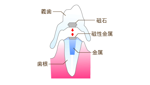 ���ꎕ�̎�ށE���΂̓��ꎕ�E�l�I�W������