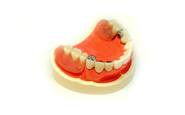 ���^���ł��鐸���`���E�A�^�b�`�����g�̓��ꎕ