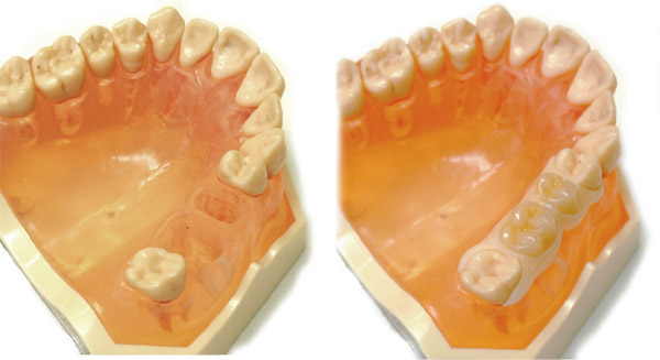 �������Ȃ��E�F���f���c�E���O����u���b�W�E�����s�`�斃�z�\��