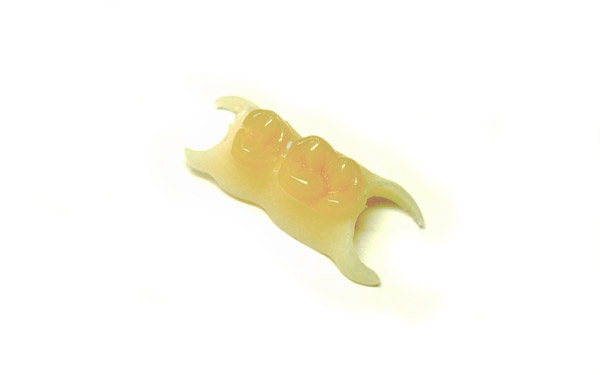 歯を削らないブリッジ・取り外し可能なウェルデンツ・東京都港区麻布十番